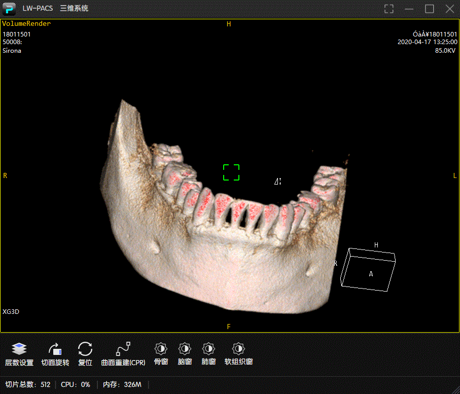 C#开发PACS医学影像三维重建(十四):基于能量模型算法将曲面牙床展开至二维平面