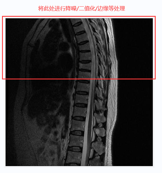 C#处理医学影像(四):基于Stitcher算法拼接人体全景脊柱骨骼影像