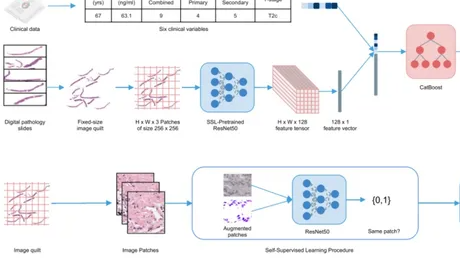 基于随机化三期临床试验数据和多模态深度学习的前列腺癌治疗方案个性化